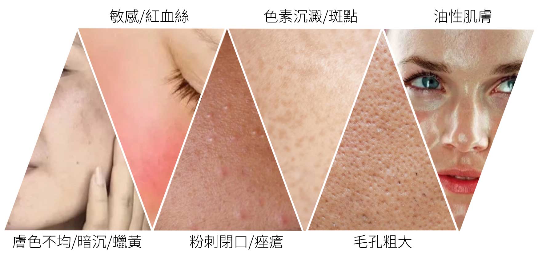 geneoX_氧氣嫩膚_活氧泡泡_價格_費用_禁忌_多少_評價_PTT_dcard_推薦_原理