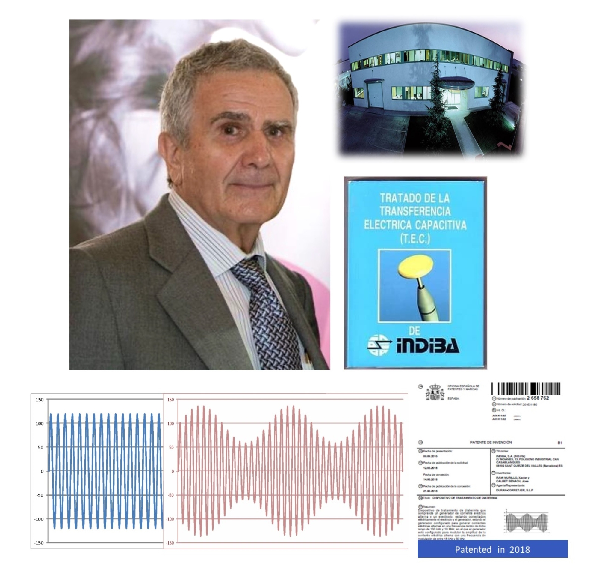 Indiba_英特波_448khz_巴塞隆納_電波_產生內生熱_提高基礎體溫_加速細胞新陳代謝_促進血液循環_增強免疫力_緩解肌肉僵硬_提升睡眠品質_活化身體機能