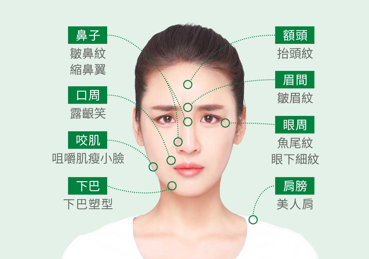 英國_皇家_肉毒_DYSPORT_適應症_施打部位_額頭_鼻子_口周_眉間_眼周_肩膀_咬肌_下巴_小腿