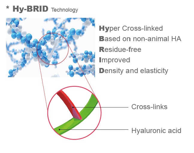 MONALISA_韓式_蒙娜麗莎玻尿酸_愛玻尿酸_李蒨蓉_蒙娜麗莎玻尿酸為非動物性來源玻尿酸，採用獨特的HY-BRID交聯技術，可以大幅提高交聯效率、並降低化學交聯劑殘(BDDE)留量，提高產品與使用者安全性，降低敏感與水腫機率。