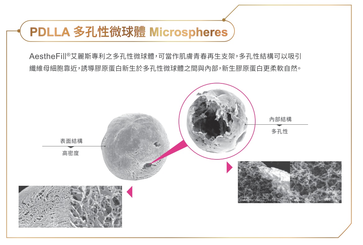 Aesthefill_艾麗斯_精靈針_聚雙旋乳酸_聚左旋乳酸_膠原蛋白增生_水光注射_PLA_PLLA_PDLLA_多孔性微球體_CMC_元晨診所_台北_板橋_台中_忠孝復興_中山_府中_勤美