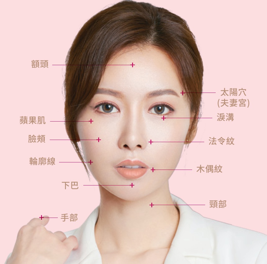 Aesthefill_艾麗斯_精靈針_聚雙旋乳酸_施打部位_額頭_蘋果肌_臉頰_輪廓線_下巴_手部_太陽穴_夫妻宮_淚溝_木偶紋_頸部_元晨診所_台北_板橋_台中_忠孝復興_中山_府中_勤美
