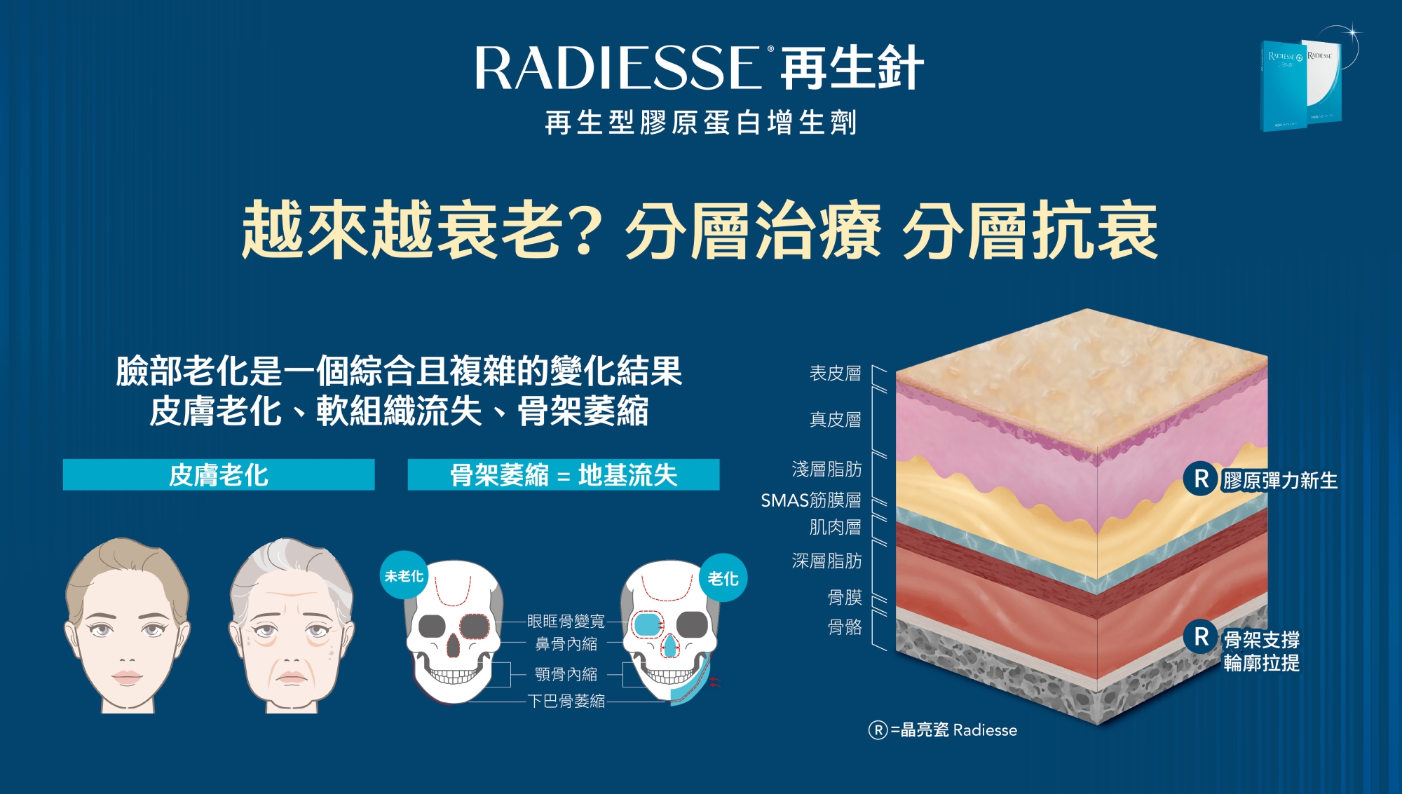 RDS_Radiesse_晶亮瓷_微晶瓷_再生針_膠原新生_彈力支撐_輪廓拉提_元晨診所