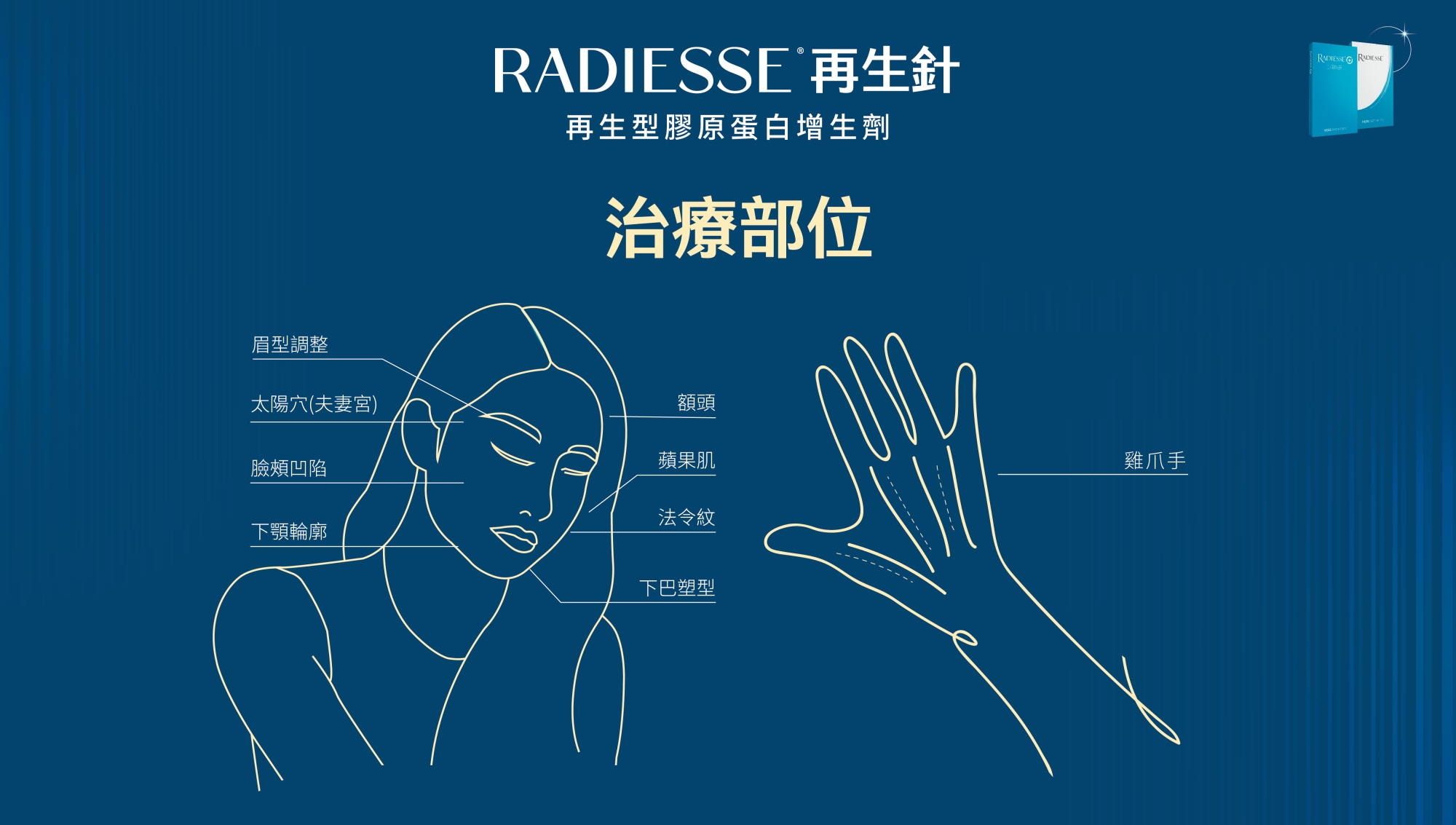 RDS_Radiesse_晶亮瓷_微晶瓷_再生針_膠原新生_彈力支撐_輪廓拉提_額頭_太陽穴_夫妻宮_臉頰凹陷_法令紋_木偶紋_蘋果肌_下顎輪廓線_下巴塑型_手部_雞爪手