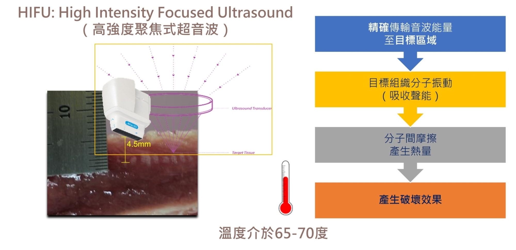 Jeisys_Z音波_第五代音波_價格_費用_禁忌_多少_評價_PTT_dcard_推薦_原理